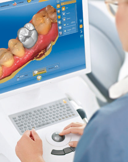 Erstellung eines 3D-Modells des Zahnersatzes am Computer